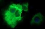 PLA2G16 Antibody in Immunocytochemistry (ICC/IF)