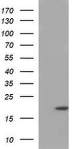 PLA2G16 Antibody in Western Blot (WB)