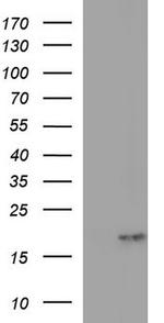 PLA2G16 Antibody in Western Blot (WB)