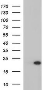 PLA2G16 Antibody in Western Blot (WB)