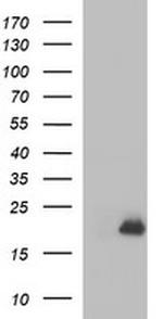 PLA2G16 Antibody in Western Blot (WB)