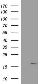 PLA2G16 Antibody in Western Blot (WB)