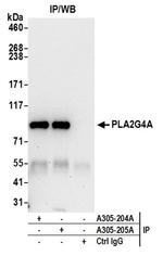 PLA2G4A/cPLA2 Antibody in Western Blot (WB)