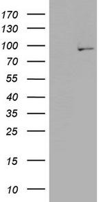 PLA2G6 Antibody in Western Blot (WB)