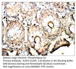 Phospholipase A2 Antibody in Immunohistochemistry (IHC)