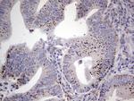 PLAU Antibody in Immunohistochemistry (Paraffin) (IHC (P))