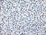 PLK1 Antibody in Immunohistochemistry (Paraffin) (IHC (P))