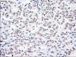 PLK1 Antibody in Immunohistochemistry (Paraffin) (IHC (P))