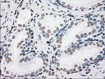 PLK1 Antibody in Immunohistochemistry (Paraffin) (IHC (P))