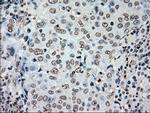 PLK1 Antibody in Immunohistochemistry (Paraffin) (IHC (P))