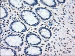 PLK1 Antibody in Immunohistochemistry (Paraffin) (IHC (P))