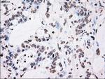 PLK1 Antibody in Immunohistochemistry (Paraffin) (IHC (P))