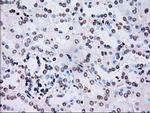 PLK1 Antibody in Immunohistochemistry (Paraffin) (IHC (P))