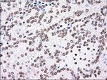 PLK1 Antibody in Immunohistochemistry (Paraffin) (IHC (P))