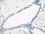 PLK1 Antibody in Immunohistochemistry (Paraffin) (IHC (P))