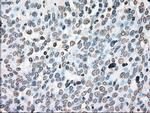 PLK1 Antibody in Immunohistochemistry (Paraffin) (IHC (P))