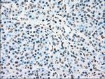 PLK1 Antibody in Immunohistochemistry (Paraffin) (IHC (P))