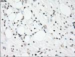 PLK1 Antibody in Immunohistochemistry (Paraffin) (IHC (P))