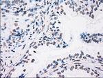 PLK1 Antibody in Immunohistochemistry (Paraffin) (IHC (P))