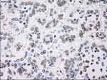 PLK1 Antibody in Immunohistochemistry (Paraffin) (IHC (P))