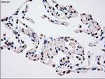 PLK1 Antibody in Immunohistochemistry (Paraffin) (IHC (P))