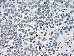 PLK1 Antibody in Immunohistochemistry (Paraffin) (IHC (P))