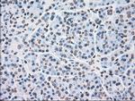 PLK1 Antibody in Immunohistochemistry (Paraffin) (IHC (P))