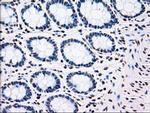 PLK1 Antibody in Immunohistochemistry (Paraffin) (IHC (P))