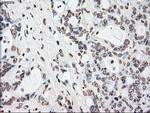 PLK1 Antibody in Immunohistochemistry (Paraffin) (IHC (P))