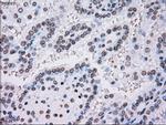 PLK1 Antibody in Immunohistochemistry (Paraffin) (IHC (P))