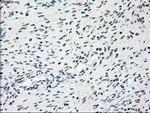 PLK1 Antibody in Immunohistochemistry (Paraffin) (IHC (P))