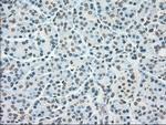 PLK1 Antibody in Immunohistochemistry (Paraffin) (IHC (P))