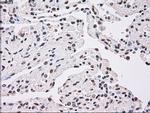 PLK1 Antibody in Immunohistochemistry (Paraffin) (IHC (P))