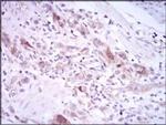 PLK1 Antibody in Immunohistochemistry (Paraffin) (IHC (P))