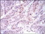 PLK1 Antibody in Immunohistochemistry (Paraffin) (IHC (P))