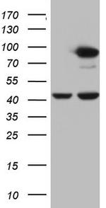 PLOD2 Antibody in Western Blot (WB)