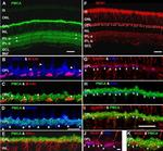 PMCA ATPase Antibody in Immunohistochemistry (IHC)