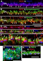 PMCA ATPase Antibody in Immunohistochemistry (IHC)