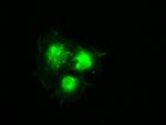 PMEL Antibody in Immunocytochemistry (ICC/IF)