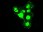 PMEL Antibody in Immunocytochemistry (ICC/IF)