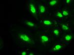 PMEL Antibody in Immunocytochemistry (ICC/IF)