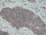 PMEL Antibody in Immunohistochemistry (Paraffin) (IHC (P))