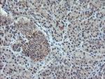 PMEL Antibody in Immunohistochemistry (Paraffin) (IHC (P))