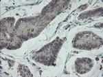 PMEL Antibody in Immunohistochemistry (Paraffin) (IHC (P))