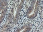 PMEL Antibody in Immunohistochemistry (Paraffin) (IHC (P))