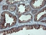 PMEL Antibody in Immunohistochemistry (Paraffin) (IHC (P))