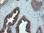 PMEL Antibody in Immunohistochemistry (Paraffin) (IHC (P))