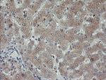 PMEL Antibody in Immunohistochemistry (Paraffin) (IHC (P))