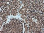 PMEL Antibody in Immunohistochemistry (Paraffin) (IHC (P))