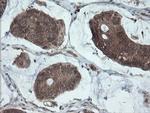 PMEL Antibody in Immunohistochemistry (Paraffin) (IHC (P))